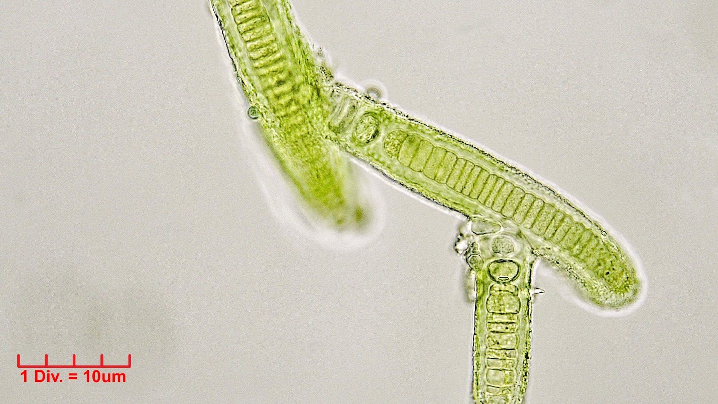 ./././Cyanobacteria/Nostocales/Tolypothrichaceae/Hassalia/byssoidea/hassalia-byssoidea-324.png
