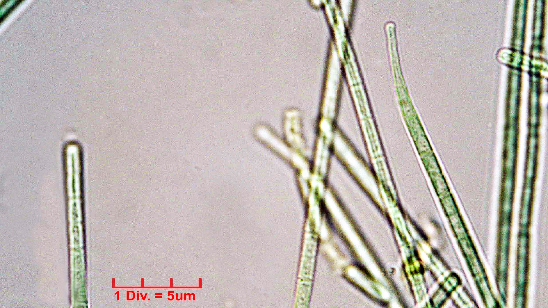 ./Cyanobacteria/Oscillatoriales/Coleofasciculaceae/Geitlerinema/splendidum/geitlerinema-splendidum-292.jpg