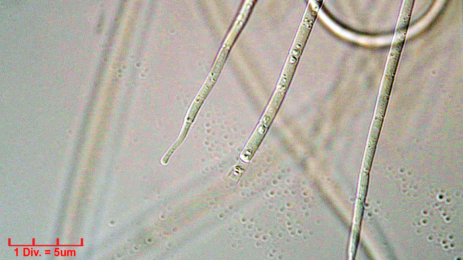 ./././Cyanobacteria/Oscillatoriales/Coleofasciculaceae/Geitlerinema/splendidum/geitlerinema-splendidum-294.jpg