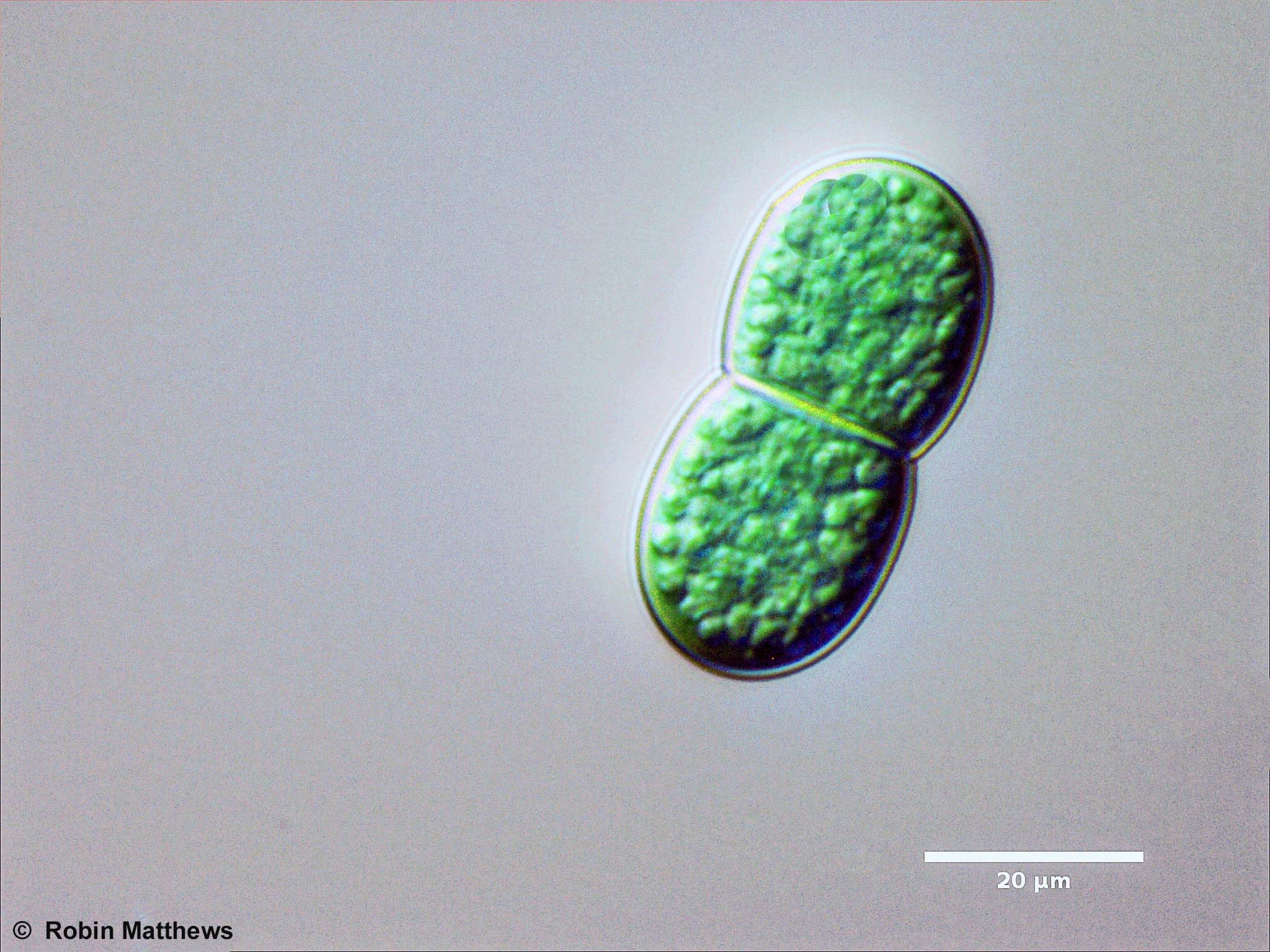 ././././Cyanobacteria/Oscillatoriales/Cyanothecaceae/Cyanothece/aeruginosa/cyanothece-aeruginosa-243.jpg
