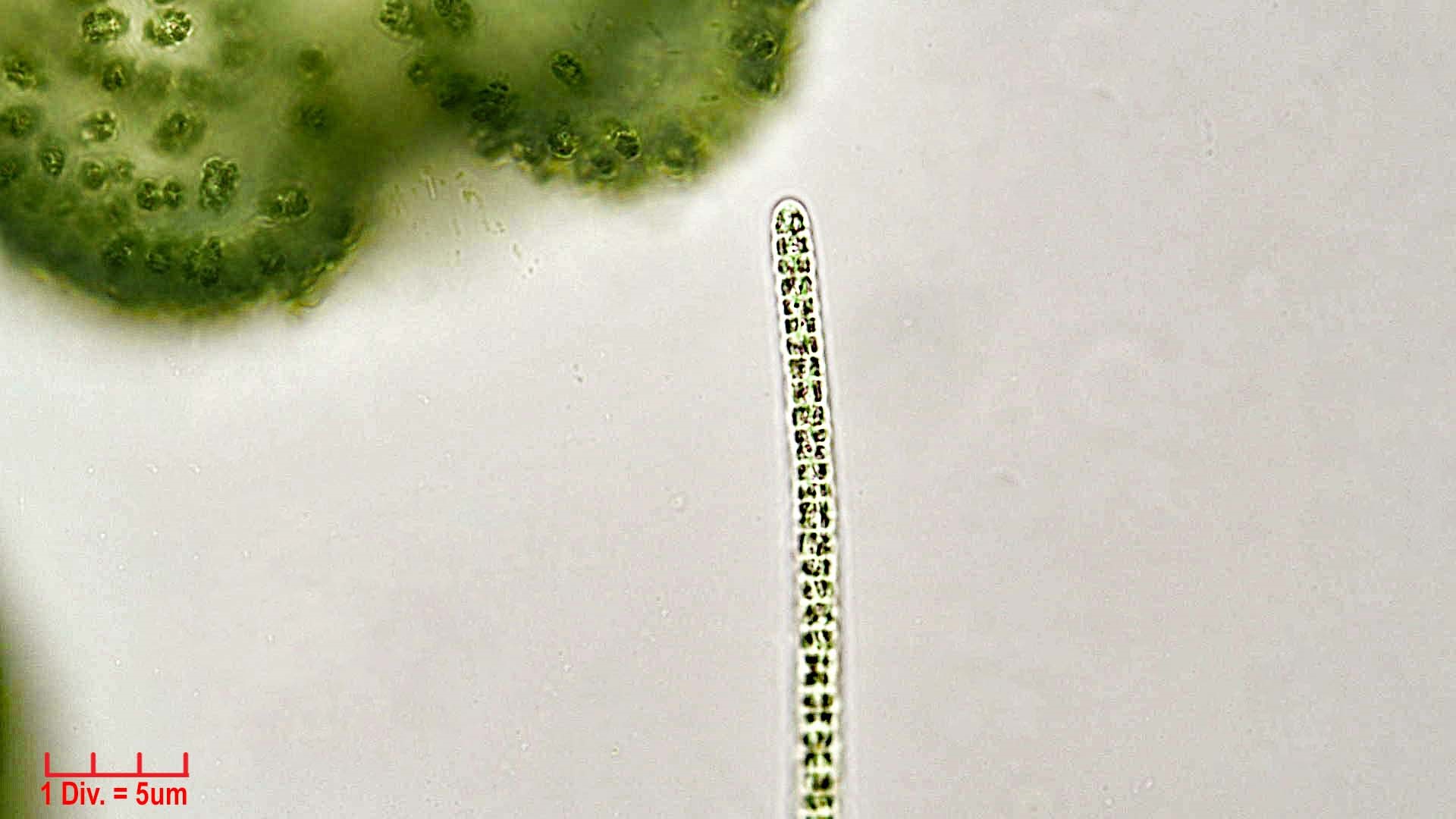Cyanobacteria/Oscillatoriales/Microcoleaceae/Planktothrix/agardhii/planktothrix-agardhii-245.jpg