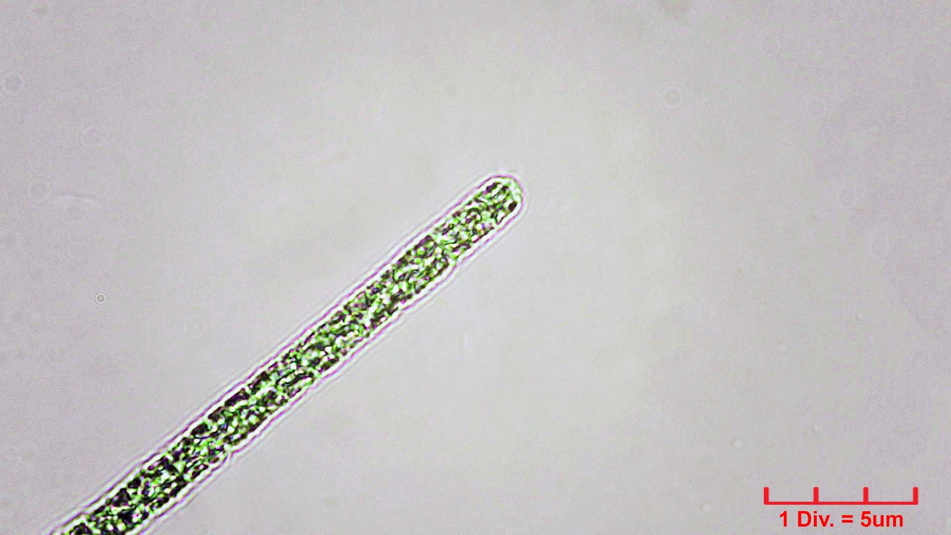 Cyanobacteria/Oscillatoriales/Microcoleaceae/Planktothrix/agardhii/planktothrix-agardhii-247.jpg