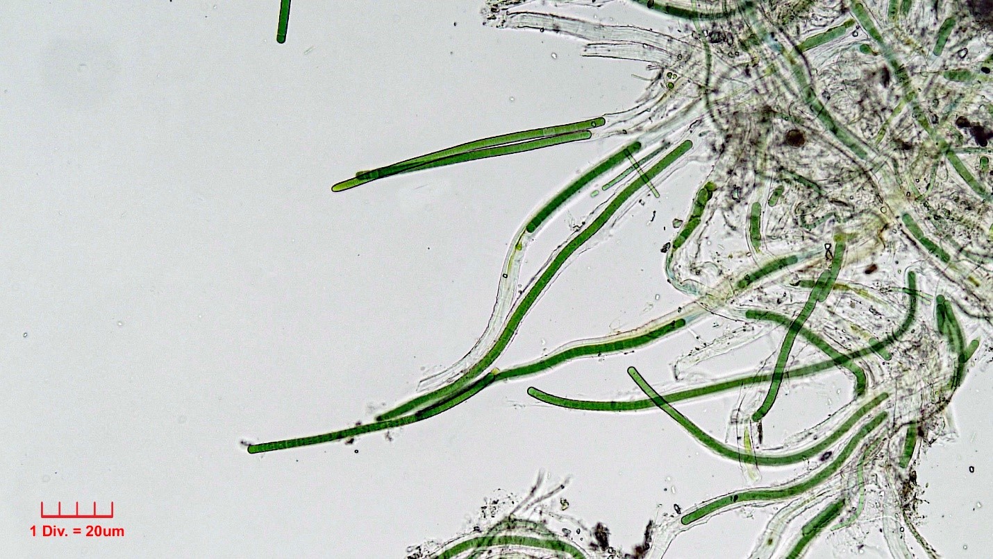 ././Cyanobacteria/Oscillatoriales/Microcoleaceae/Symplocastrum/muelleri/symplocastrum-muelleri-276.jpg