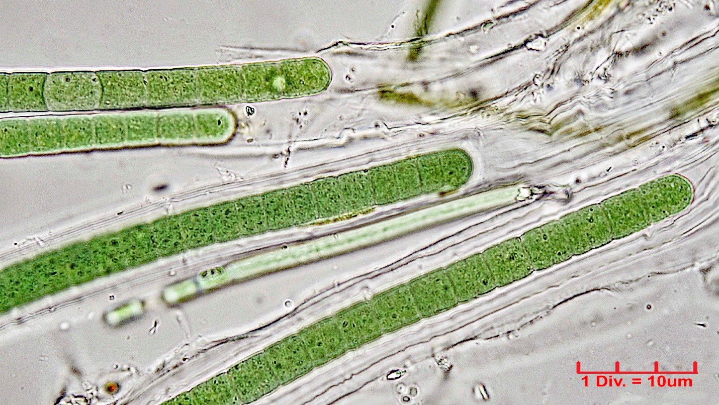 Cyanobacteria/Oscillatoriales/Microcoleaceae/Symplocastrum/muelleri/symplocastrum-muelleri-279.jpg