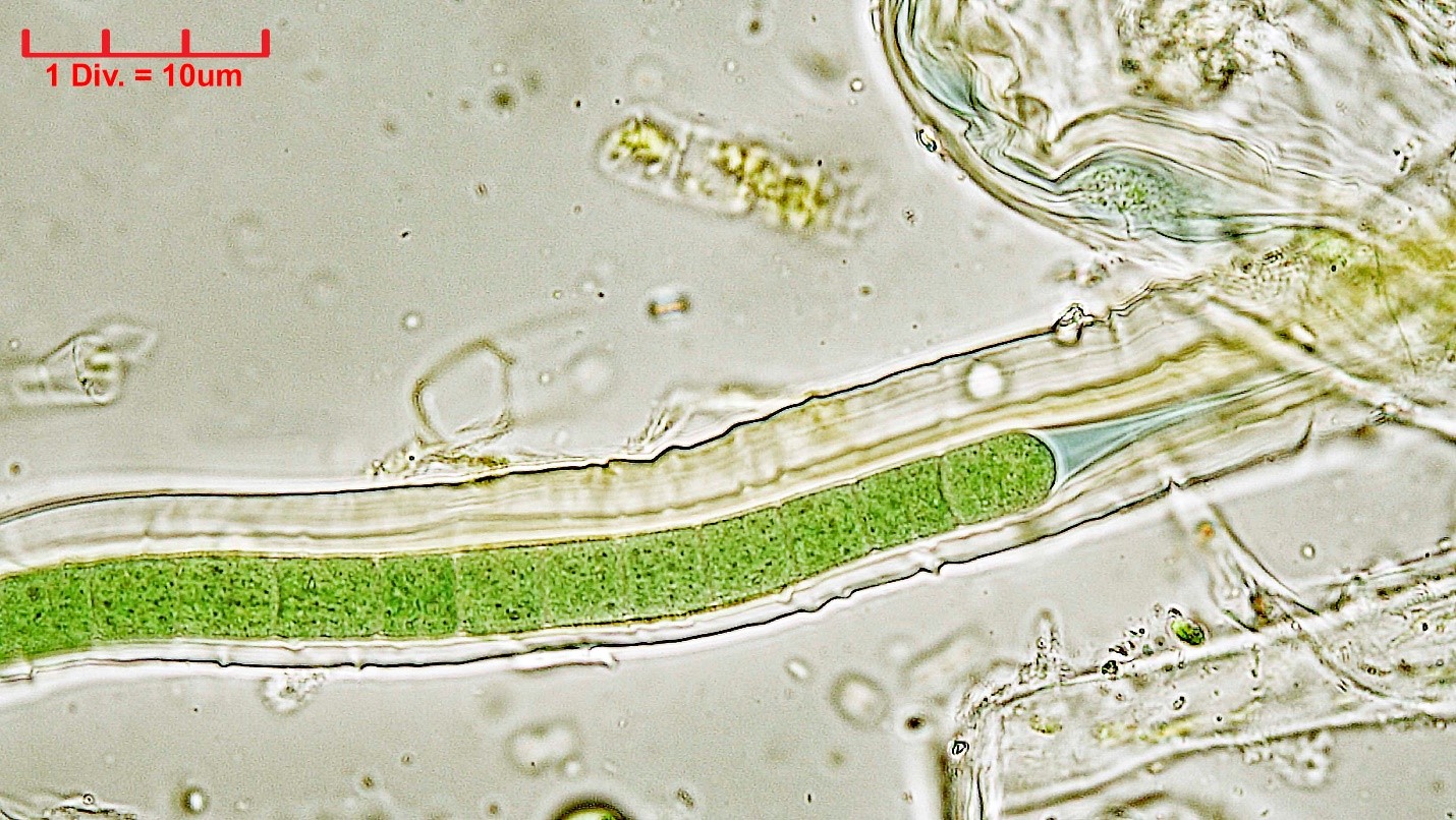 ./Cyanobacteria/Oscillatoriales/Microcoleaceae/Symplocastrum/muelleri/symplocastrum-muelleri-280.jpg
