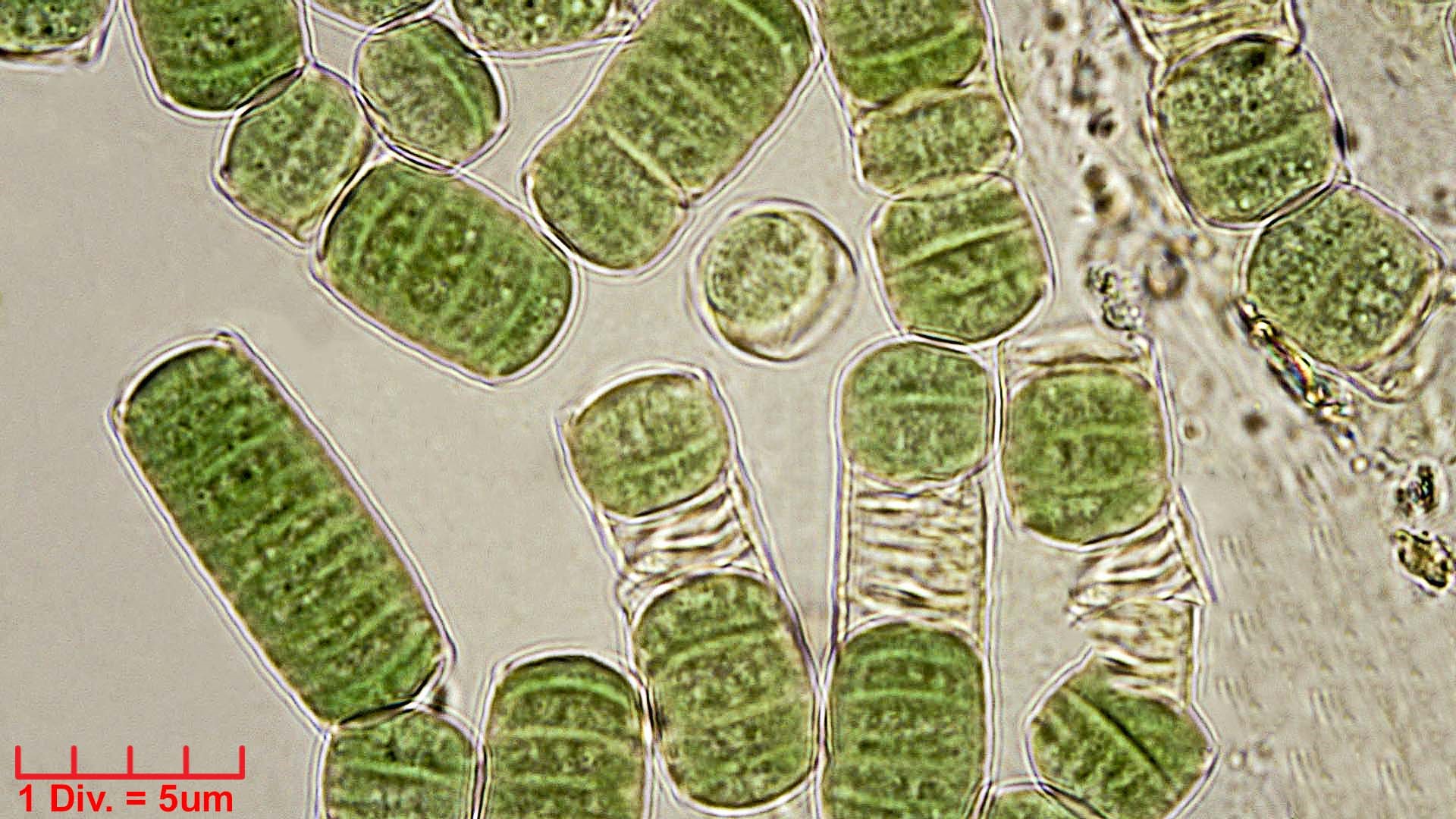 ./Cyanobacteria/Oscillatoriales/Oscillatoriaceae/Oscillatoria/curviceps/oscillatoria-curviceps-180.jpg