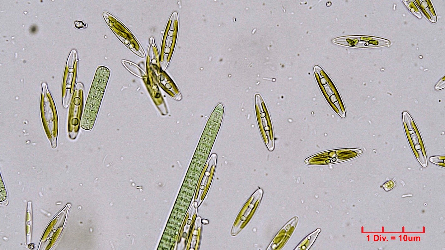 Cyanobacteria/Oscillatoriales/Oscillatoriaceae/Phormidium/uncinatum/phormidium-uncinatum-223.jpg