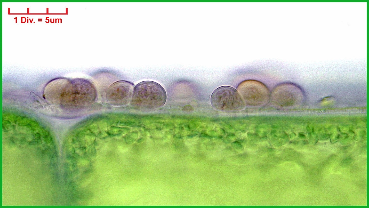 Cyanobacteria/Pleurocapsales/Dermocarpellaceae/Cyanocystis/hemisphaerica/cyanocystis-hemisphaerica-158.jpg