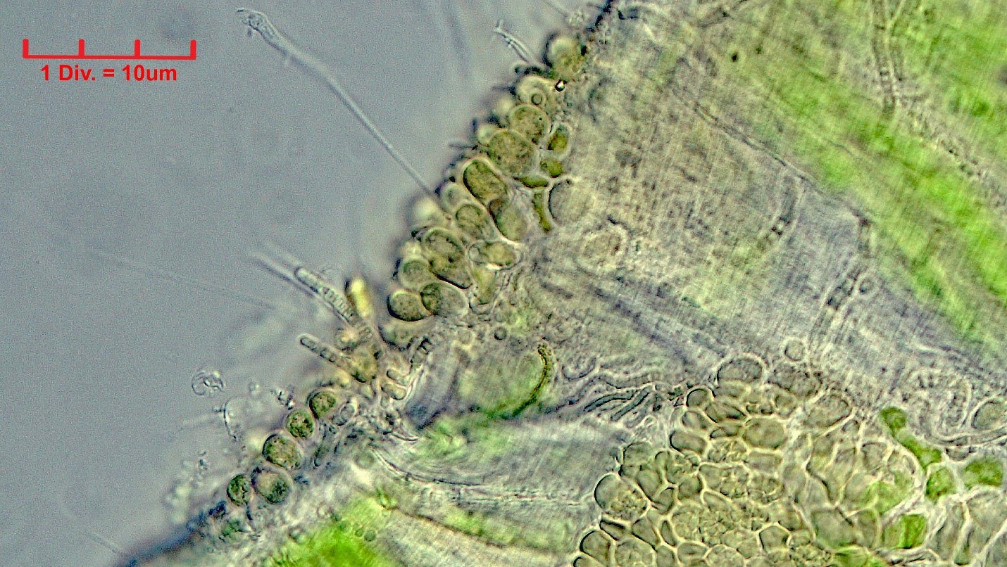 ./Cyanobacteria/Pleurocapsales/Dermocarpellaceae/Cyanocystis/violaceae/cyanocystis-violaceae-156.jpg