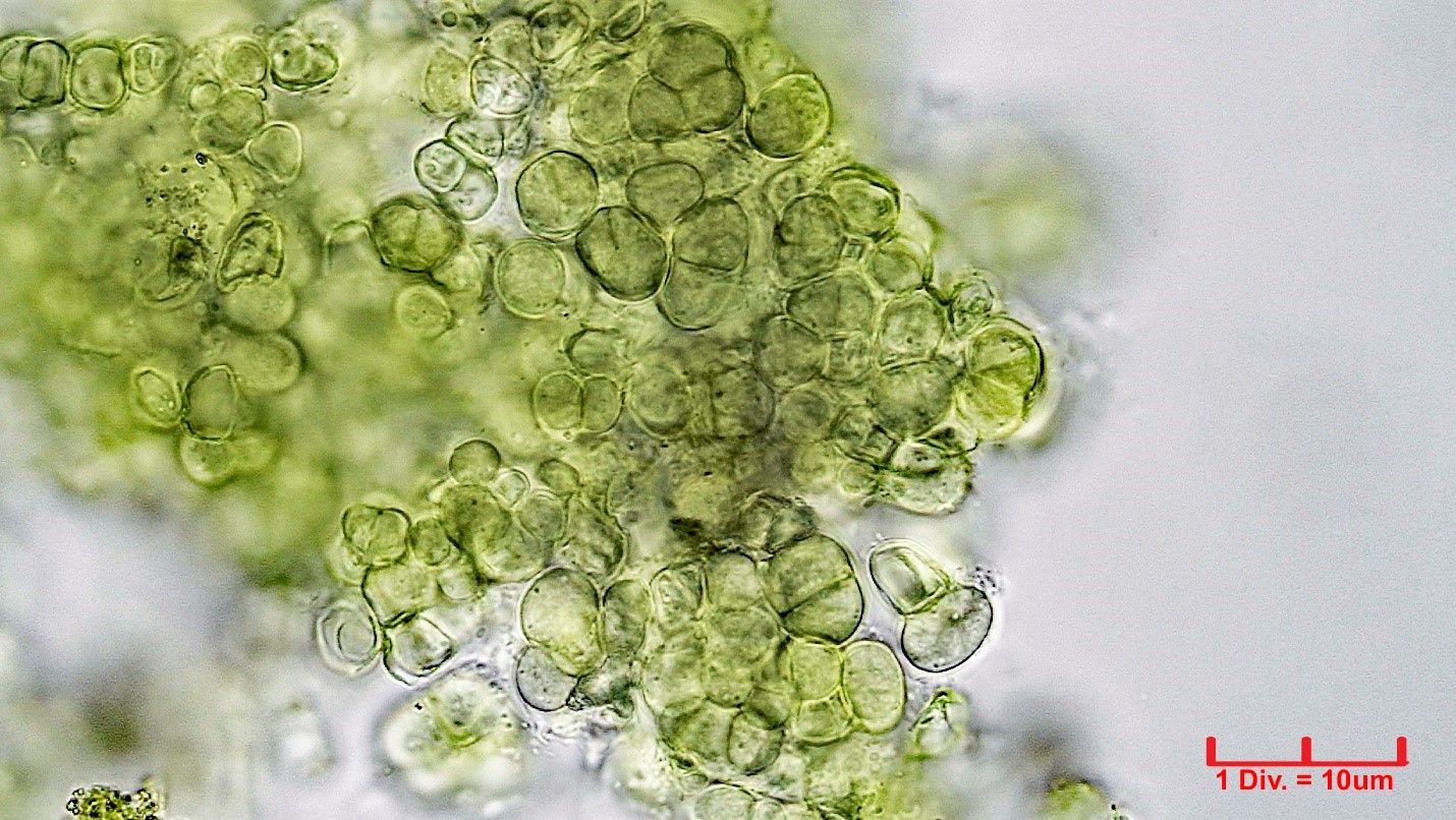 Cyanobacteria/Pleurocapsales/Hyellaceae/Pleurocapsa/sp/pleurocapsa-160.jpg