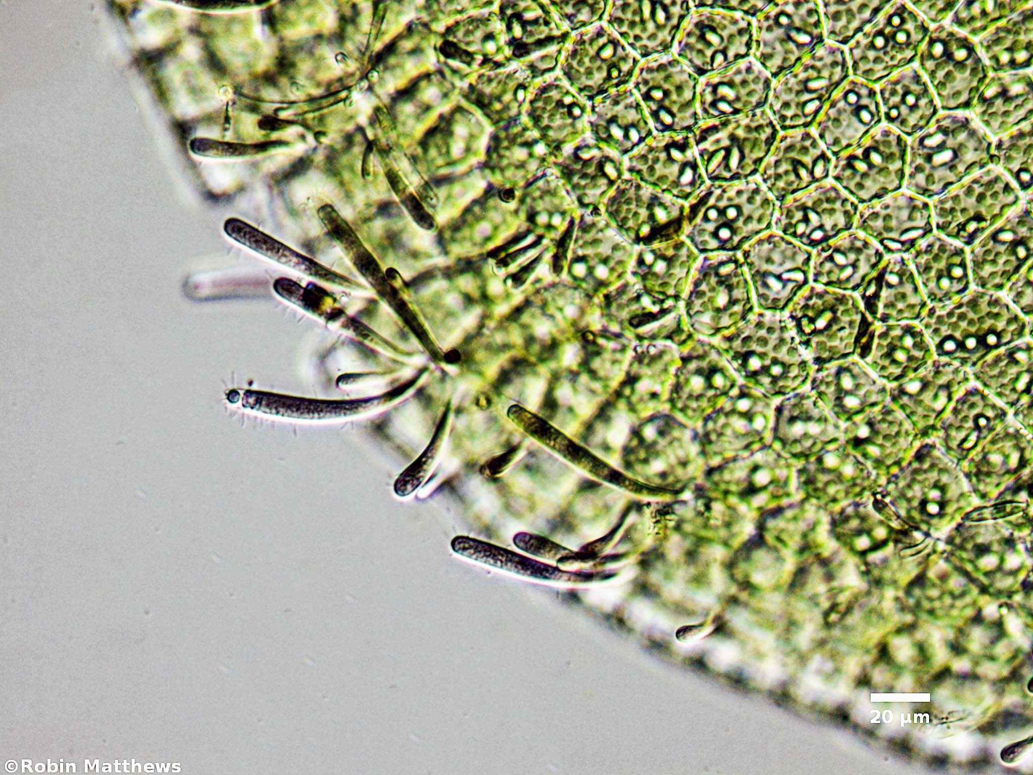 Cyanobacteria/Synechococcales/Chamaesiphonaceae/Chamaesiphon/convervicolus/chamaesiphon-convervicolus-76.jpg