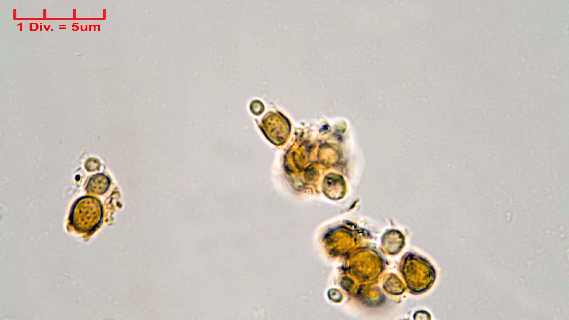 ././Cyanobacteria/Synechococcales/Chamaesiphonaceae/Chamaesiphon/polonicus/chamaesiphon-polonicus-64.jpg