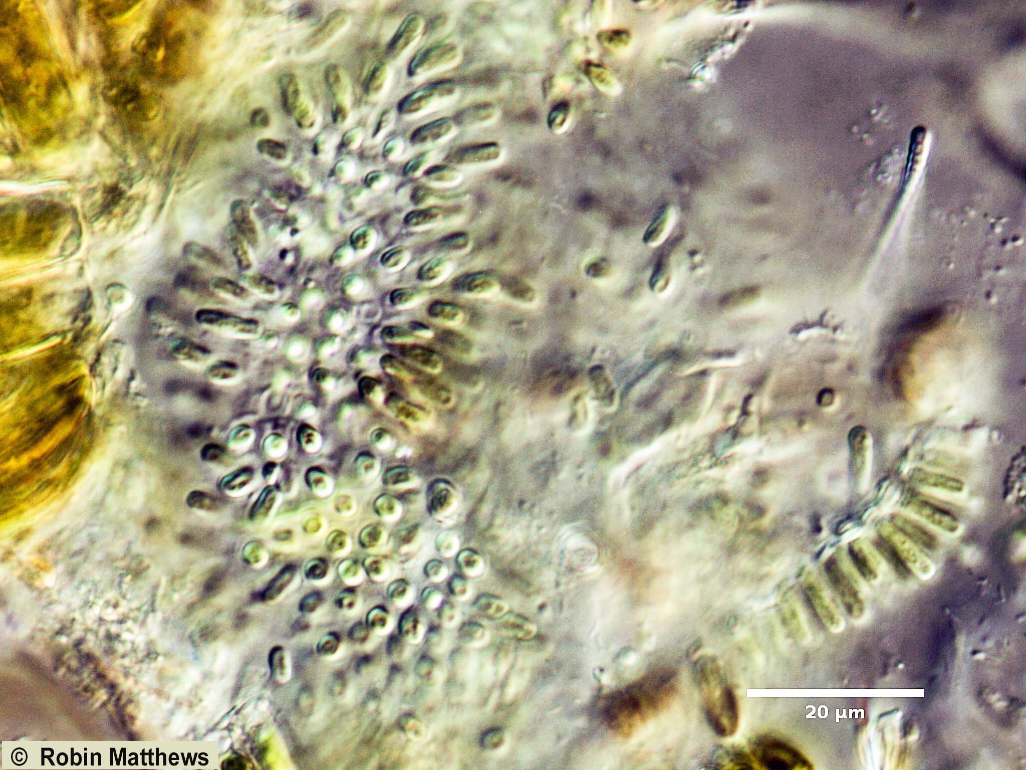 Cyanobacteria/Synechococcales/Chamaesiphonaceae/Geitlerbactron/periphyticum/geitlerbactron-periphyticum-92.jpg