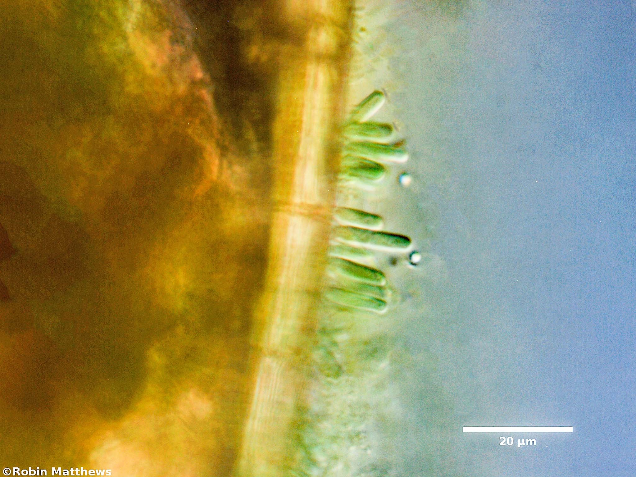 Cyanobacteria/Synechococcales/Chamaesiphonaceae/Geitlerbactron/periphyticum/geitlerbactron-periphyticum-97.jpg
