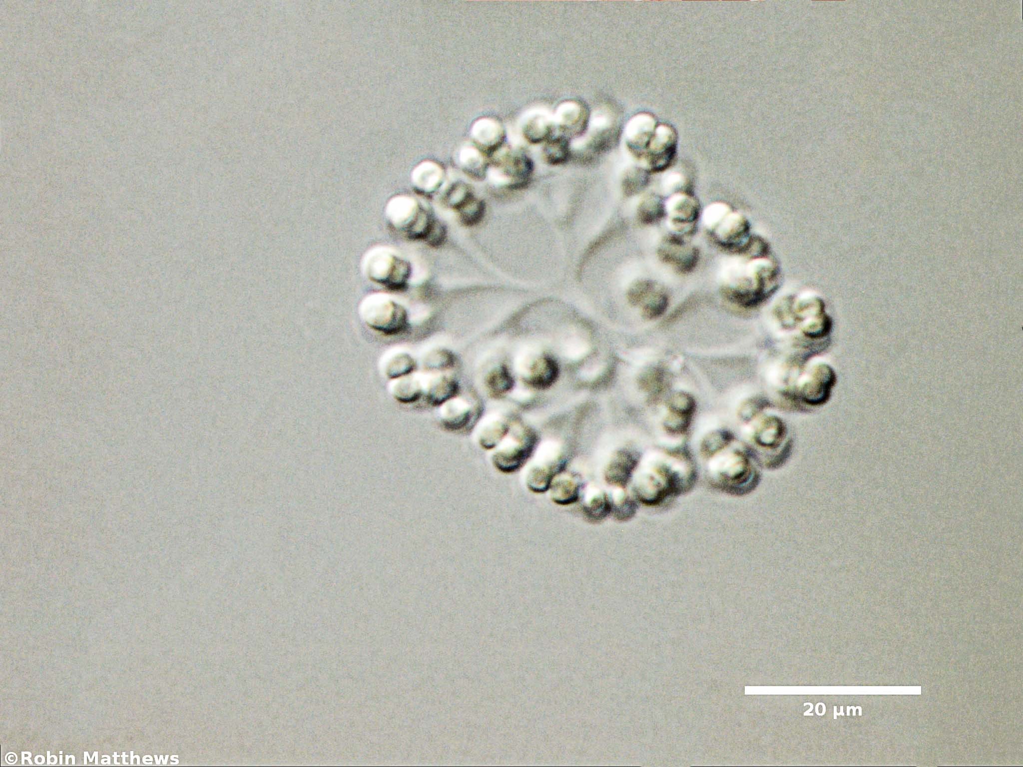 Cyanobacteria/Synechococcales/Coleosphaeriaceae/Snowella/litoralis/snowella-litoralis-102.jpg