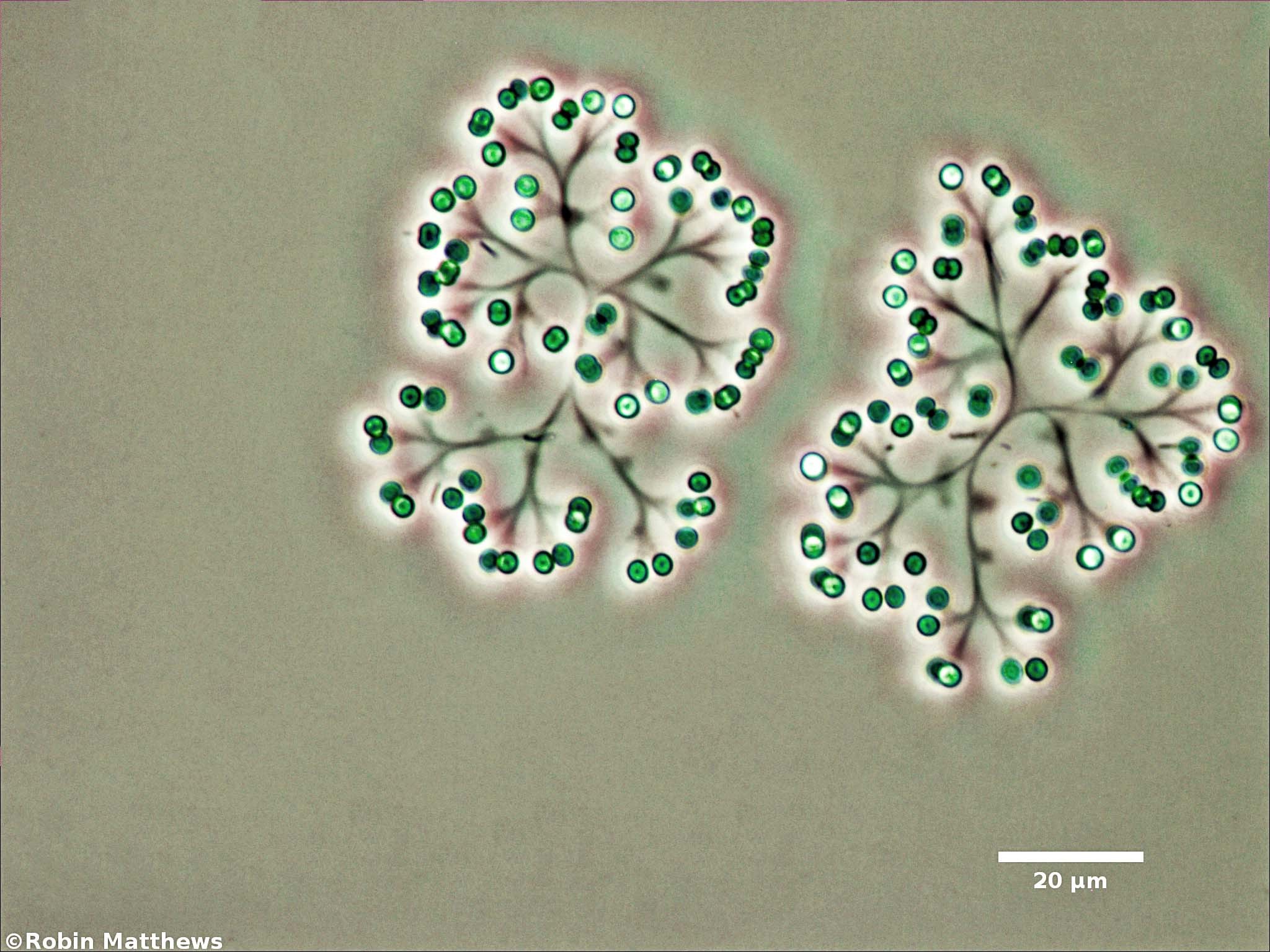 Cyanobacteria/Synechococcales/Coleosphaeriaceae/Snowella/litoralis/snowella-litoralis-104.jpg
