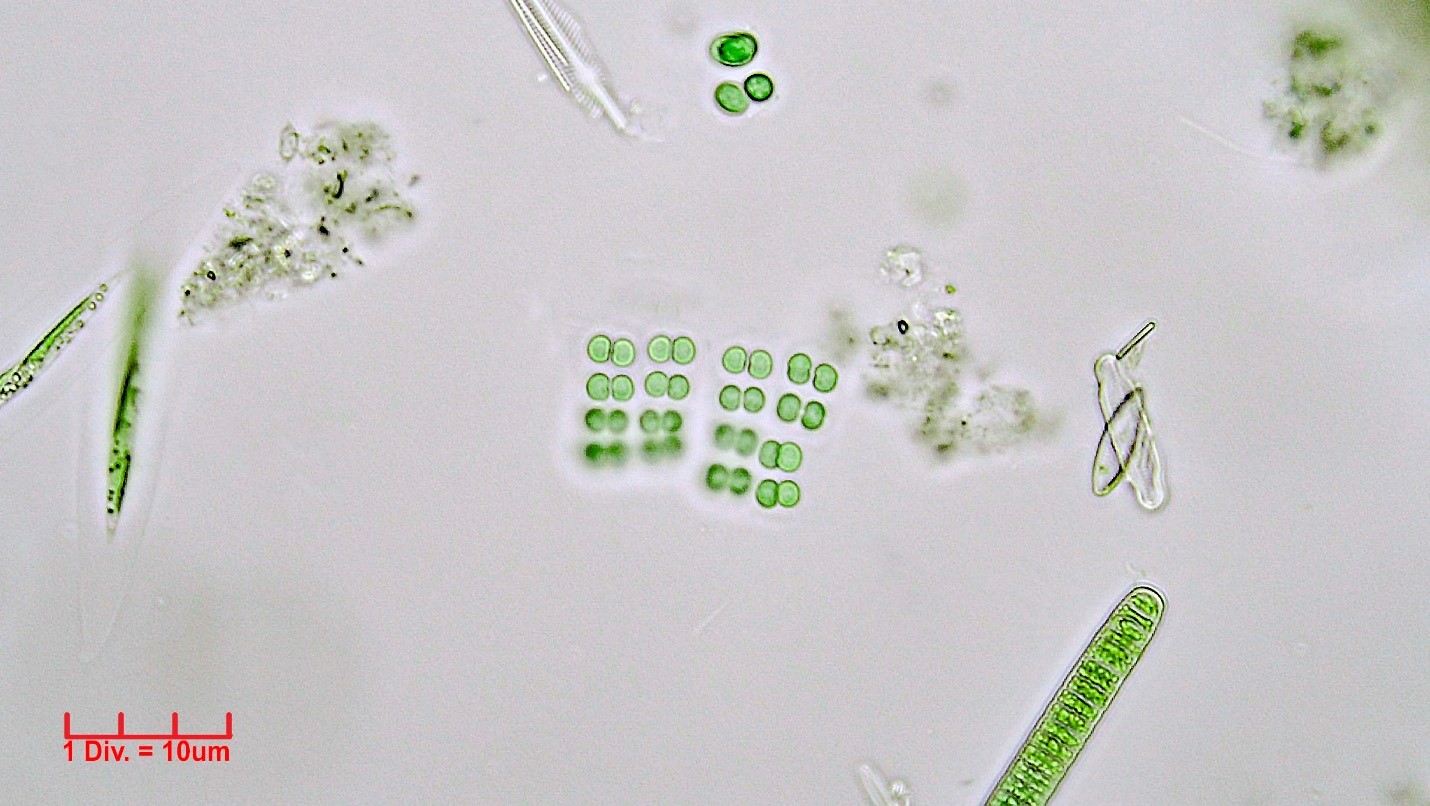 ././Cyanobacteria/Synechococcales/Merismopediaceae/Merismopedia/glauca/merismopedia-glauca-109.jpg