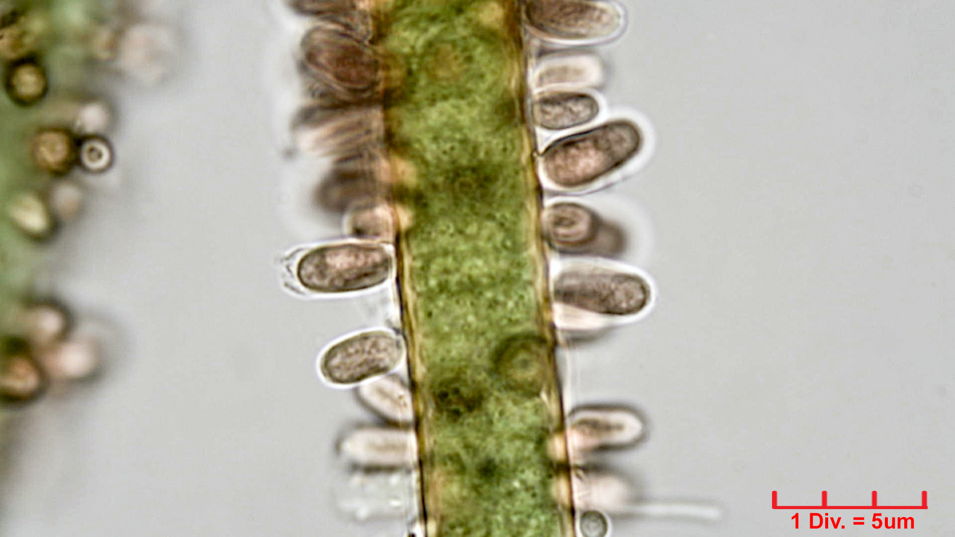 ./././Cyanobacteria/Synechococcales/Merismopediaceae/Microcrocis/geminata/microcrocis-geminata-3.jpg