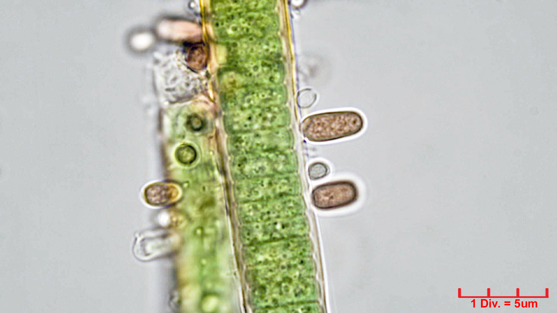 Cyanobacteria/Synechococcales/Merismopediaceae/Microcrocis/geminata/microcrocis-geminata-4.jpg