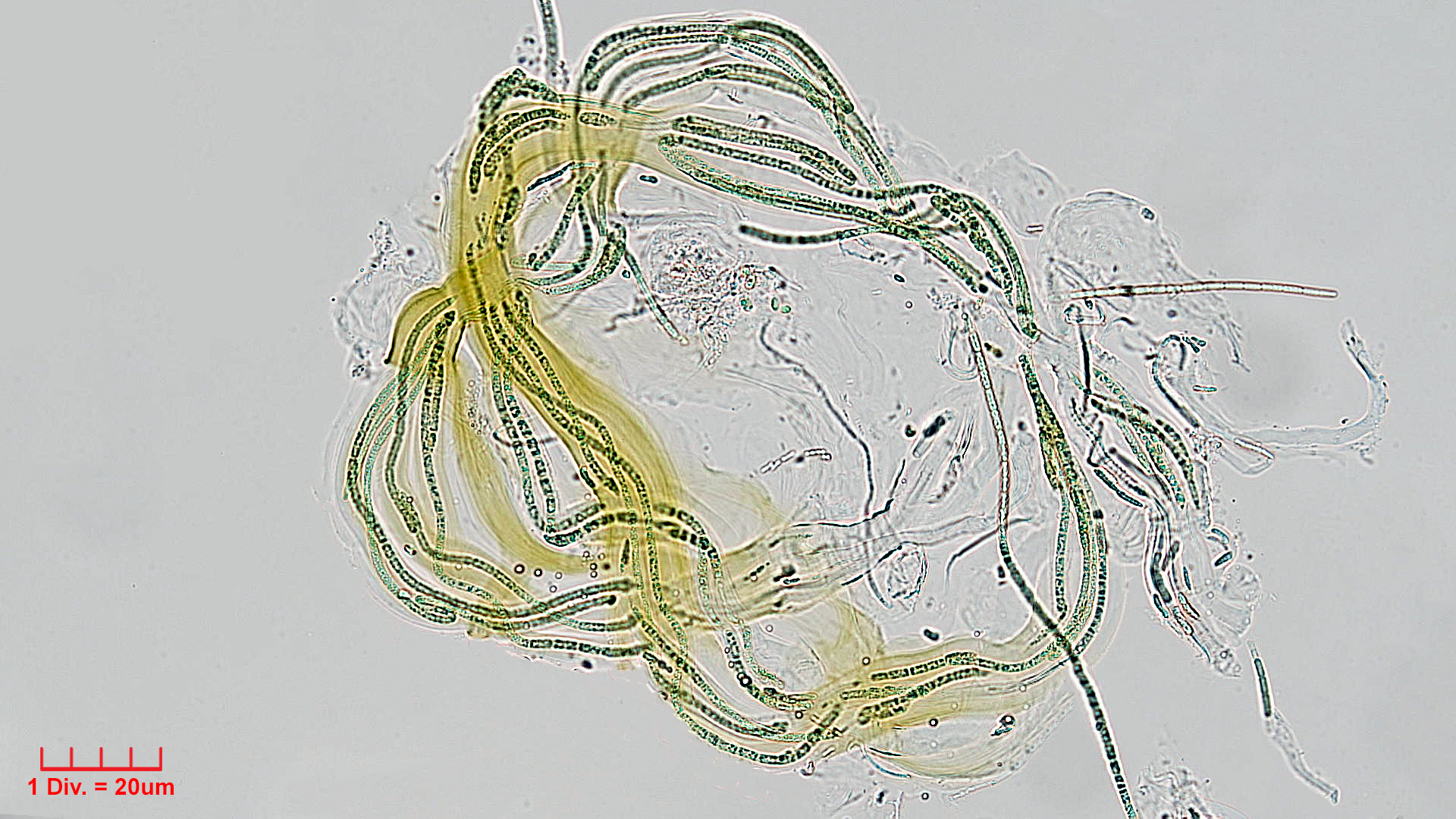 Cyanobacteria/Synechococcales/Schizotrichaceae/Dasygloea/lamyi/dasygloea-lamyi-1.jpg