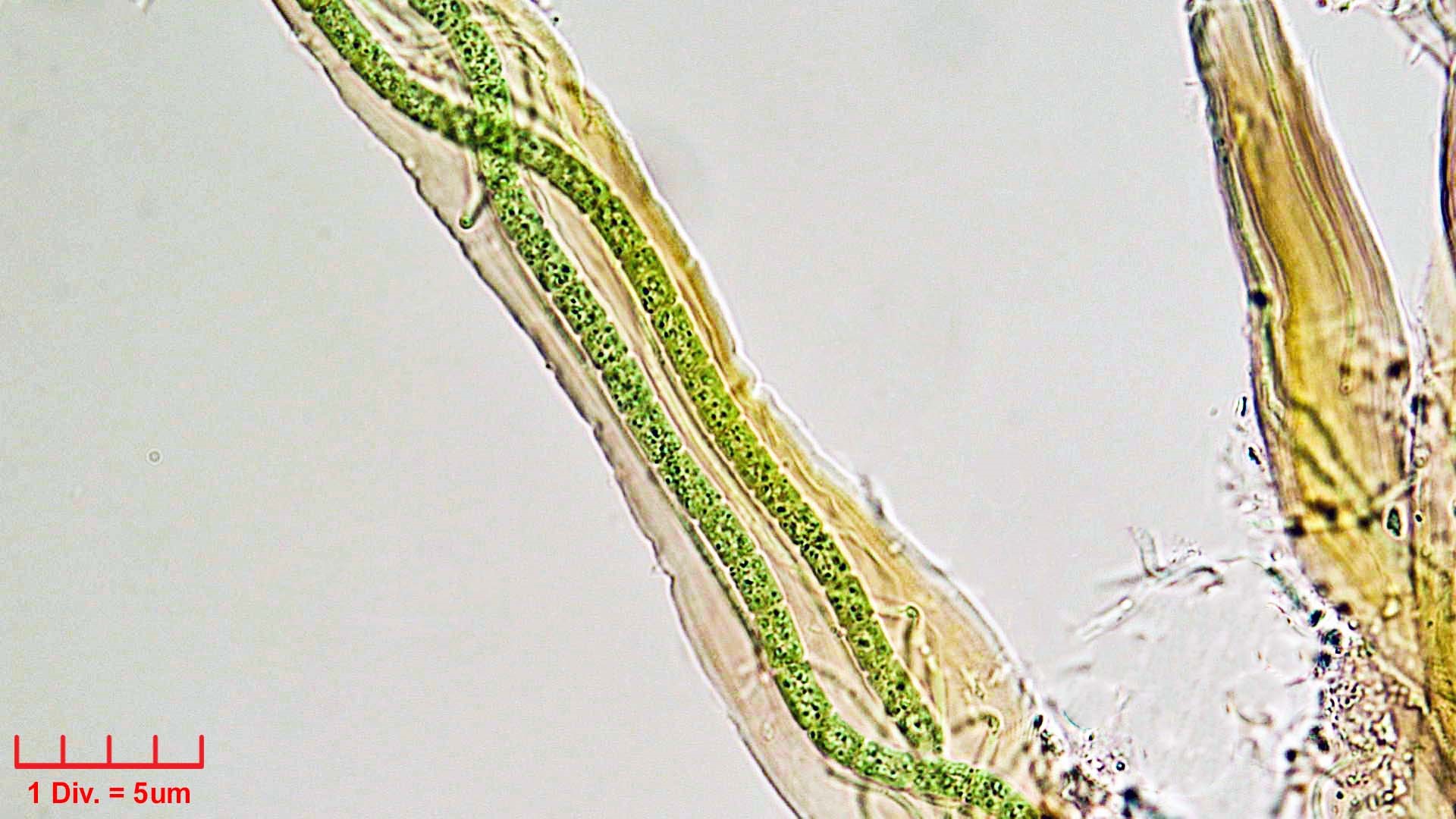 Cyanobacteria/Synechococcales/Schizotrichaceae/Dasygloea/lamyi/dasygloea-lamyi-146.jpg